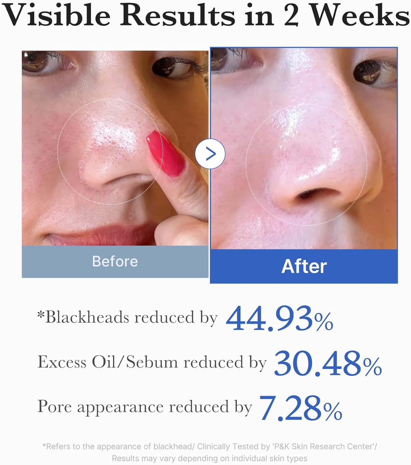 Zero Pore Toner Pads